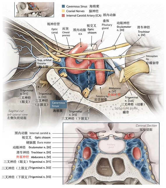 经海绵窦层面矢状面和冠状面