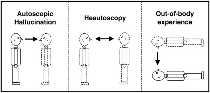 Autoscopic symptoms